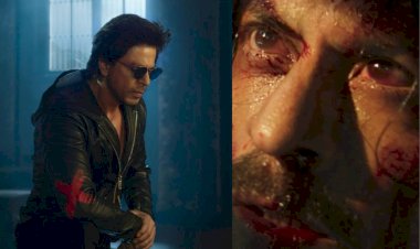 shahrukh khan accident during shooting had to undergo surgery